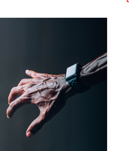 Why Are My Veins So Visible? Common Causes Explained