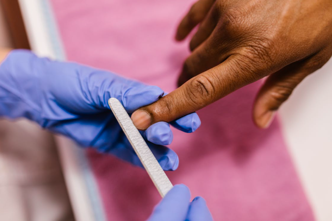 Lines on Nails: Common Causes and What They May Indicate