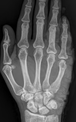 5 Drinks That May Harm Your Bone Health, According to Experts