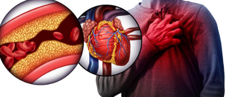 10 Possible Signs of Blocked Arteries You Should Know