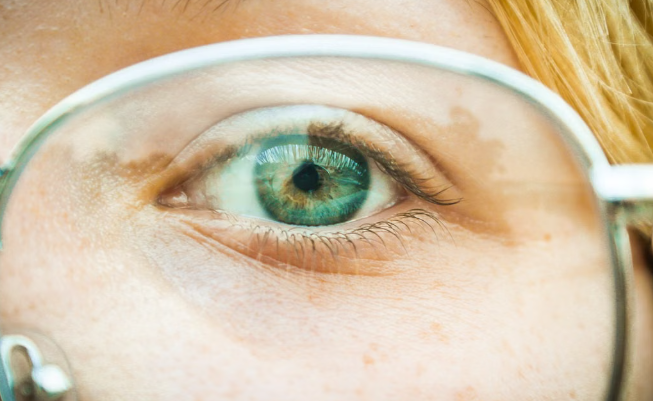 What Are Eye Floaters? Causes, Symptoms, and When to See an Eye Doctor